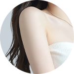 Liposuction result 2