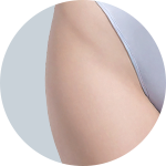 Liposuction result 5