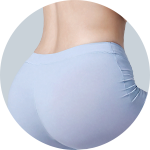 Liposuction result 6