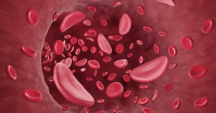 血液干细胞注射